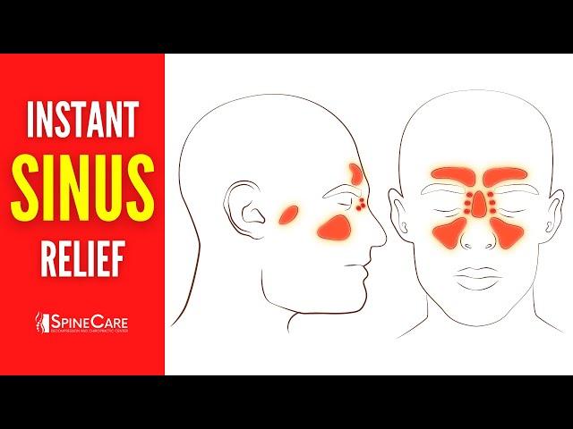 How to Relieve Sinus Congestion in 30 SECONDS