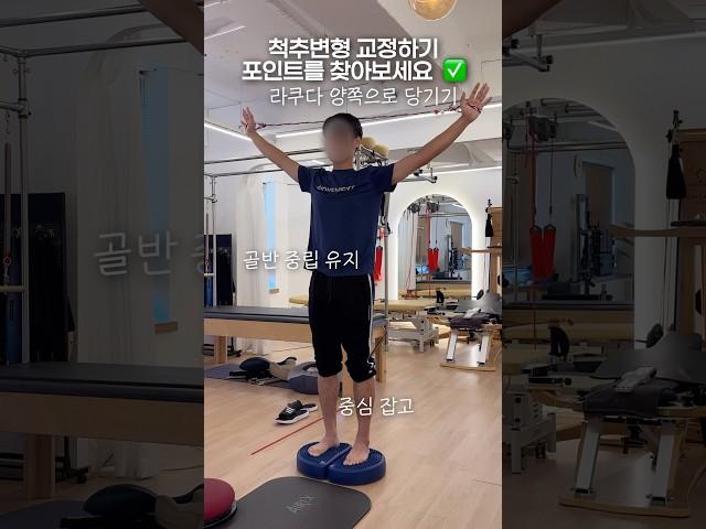 척추변형 교정하는 세 가지 포인트