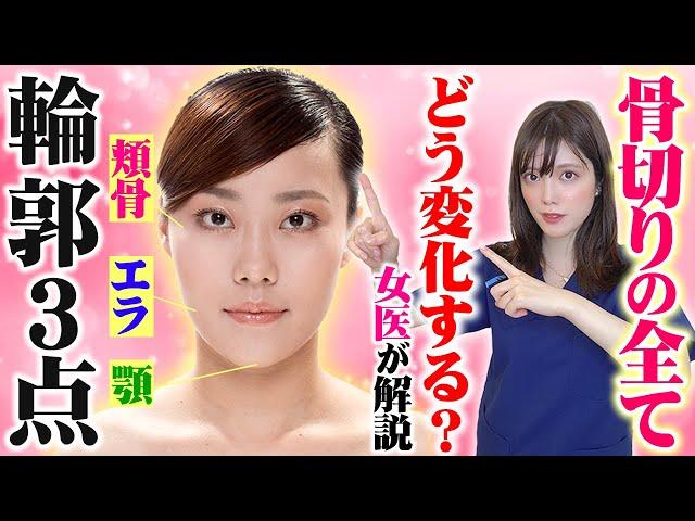 【輪郭骨切り整形】小顔にするには輪郭３点するべき？女医が解説！