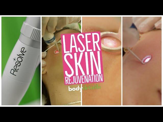 What is Laser Skin Rejuvenation? |  Body Details