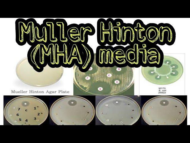 Muller Hinton (MH) media: culture media lecture 4