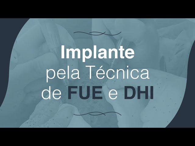 Implante Capilar - FUE & DHI