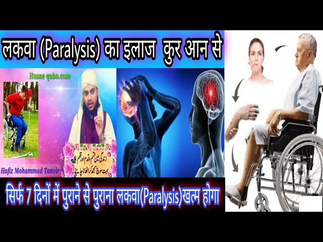 laqwa ka ilaj quran se ||Treatment of paralysis with the Quran || क़ुरान से