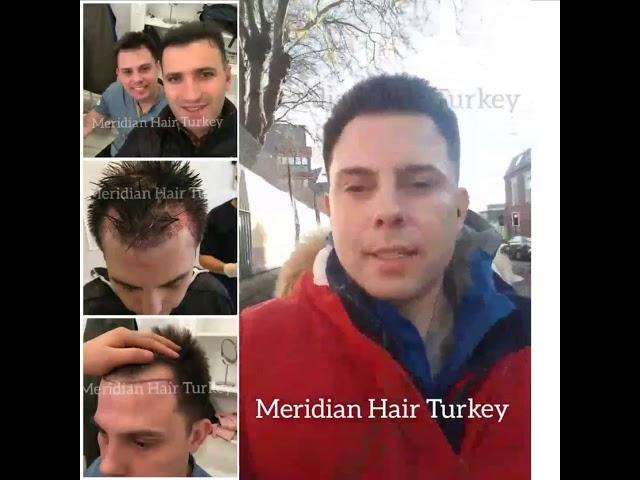 Meridian Hair Turkey