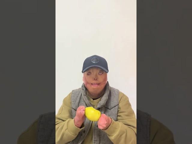 母亲刚买时就让我吃 母亲说特别甜 我傻傻地质疑我母亲 我没有吃 直到最后剩下一个我吃掉了 我发现真的超级好吃 此刻让我明白 父母可能没有很大的本事 但是永远会把好东西留给自己的孩子 可能真的