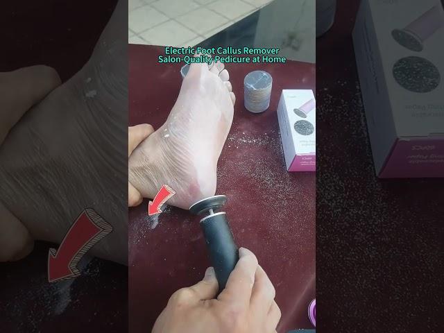 Salon-Quality Pedicure at Home! #footcallusremover #callusremoval