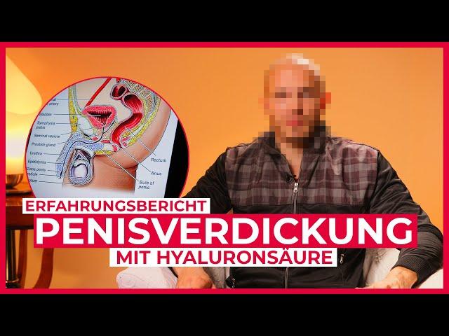 Penisvergrößerungs-Interview und Ergebnisse | Dr. Kish-Patienten