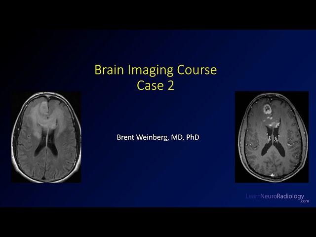 Brain imaging course – Unknown case 2