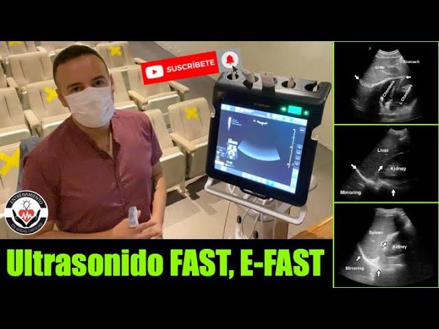 Ultrasonido FAST, E-FAST en menos de 3 minutos! By Orlando Pérez-Nieto