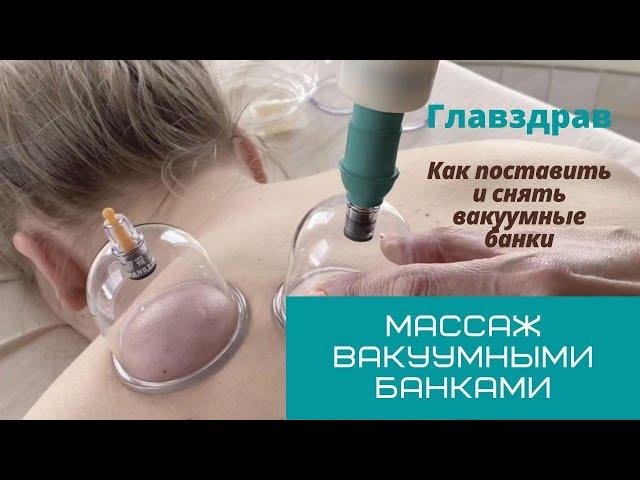 Массаж вакуумными банками. Как поставить и снять банки.