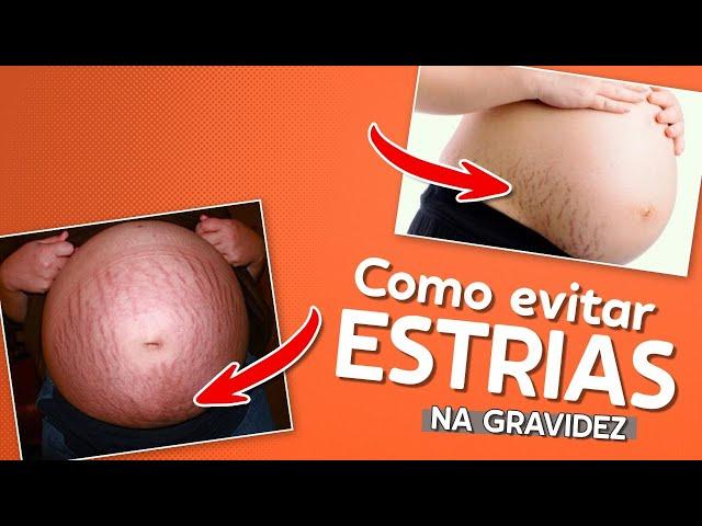 Como evitar as Estrias na Gravidez?