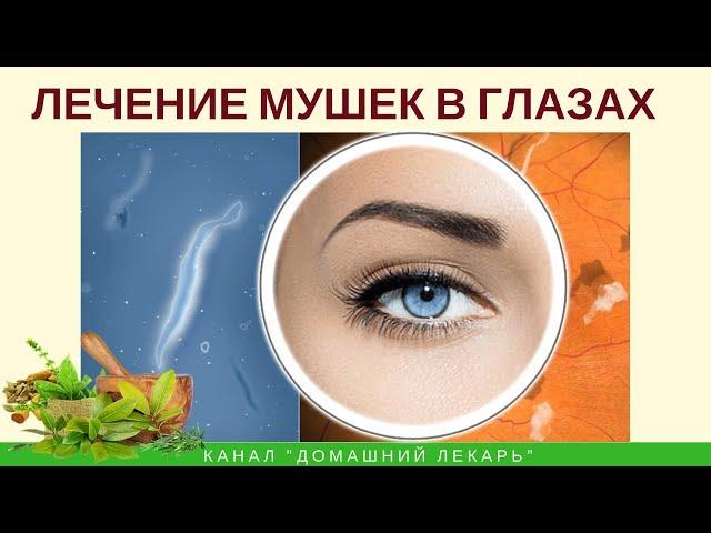 Лечение плавающих мушек в глазах: советы натуропата - Домашний лекарь - выпуск №232