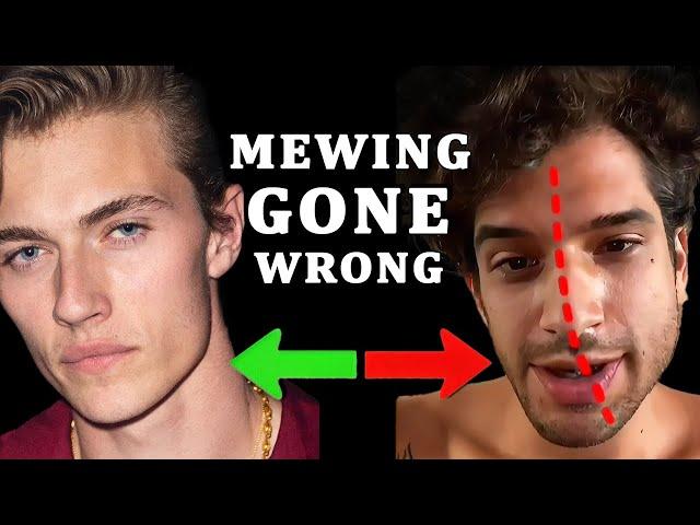 20 MEWING MISTAKES That Are Setting You Back