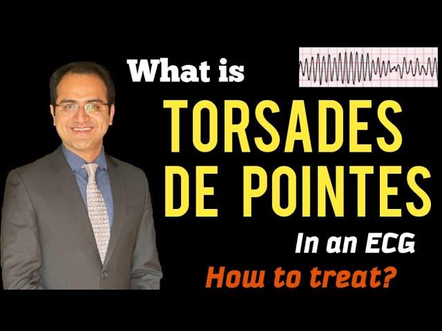 Torsades De Pointes ECG, Polymorphic Ventricular Tachycardia Treatment, ECG lectures USMLE, NCLEX