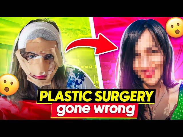 I got Plastic Surgery and Now I REGRET it  (YE KYA KAR LIYA) ?