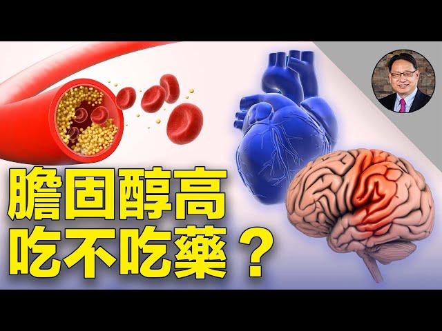 膽固醇到什麼指標，才需要吃藥？注意！他汀類藥物有這種副作用。