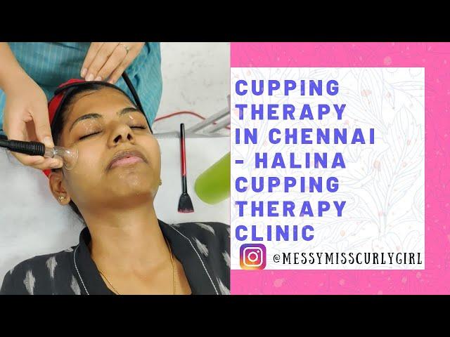 Cupping Therapy in Chennai - Glowing Skin Secret