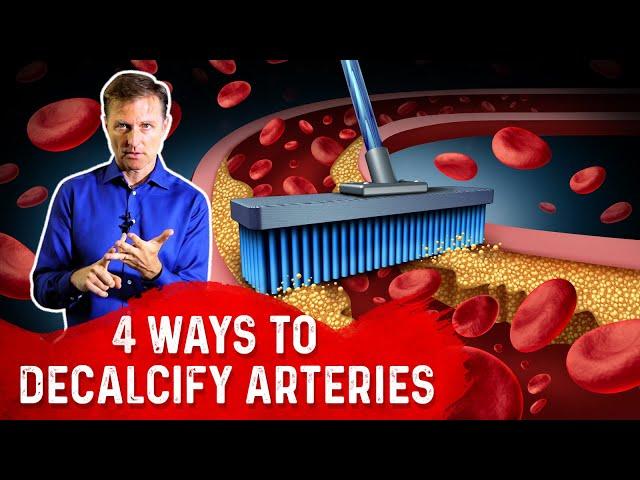 4 Ways To Decalcify Your Arteries – Dr. Berg