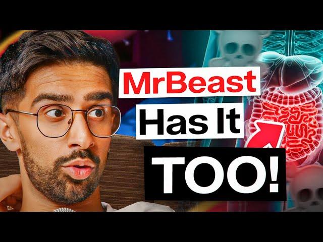 How Vikkstar Lives With Chronic Illness