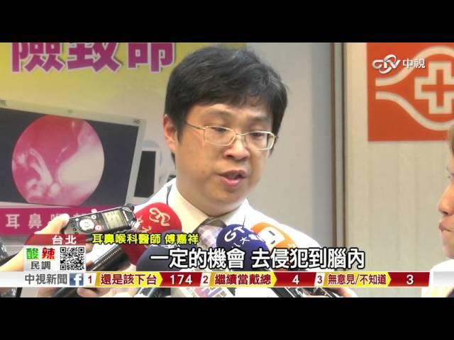 【中視新聞】200萬人潛在患者! 輕忽鼻竇炎恐致命 20150921