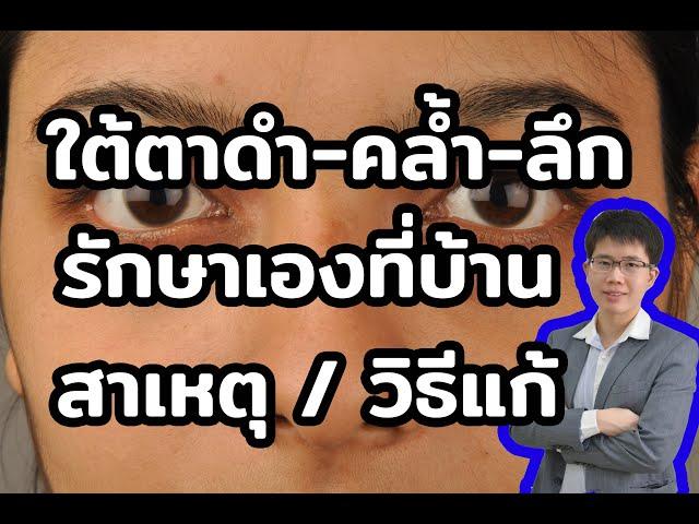 ใต้ตาดำ-คล้ำ-ลึก รักษาง่ายๆ ด้วยตัวเอง l 10นาทีกับหมอต่อ