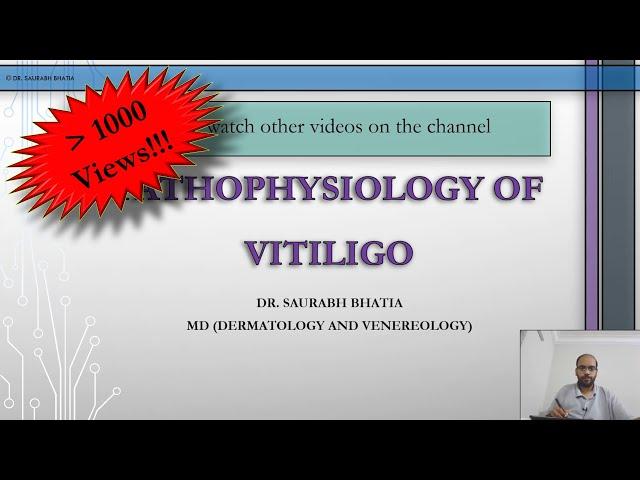 Vitiligo - Pathophysiology