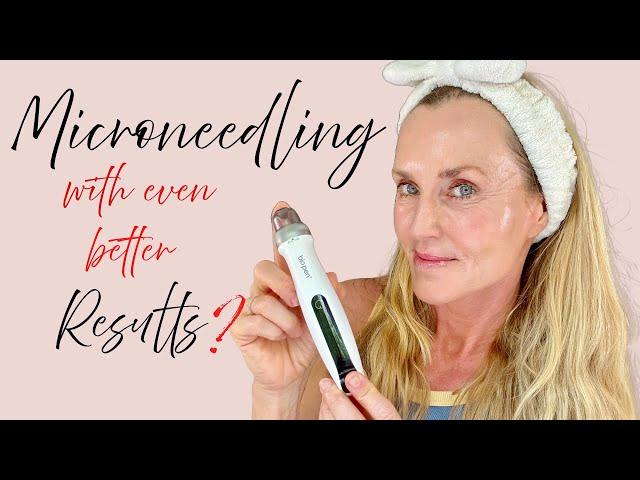 Better Results from Microneedling?  | New Bio Pen Q2: first impression & full demo