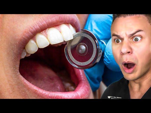 Orthodontist Reacts To WEIRDEST Dental TikToks