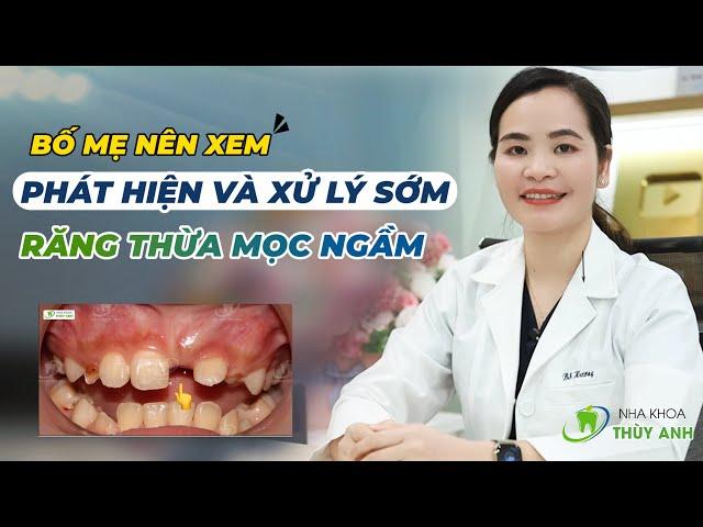 Harmful effects of extra teeth and damaged teeth - Everyone needs to know and take note