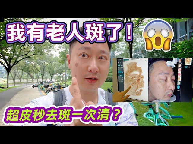 我有老人斑了🫨！超皮秒去斑一次清？｜去斑實況｜雞尾酒色素管理激光｜秋濤美膚醫療美容診所｜醫學美容｜袪斑｜脂溢性角化斑｜老人斑｜曬斑｜荷爾蒙斑 熱瑪吉｜瘦身｜熱瑪吉｜深圳美容｜保健養生｜利奧