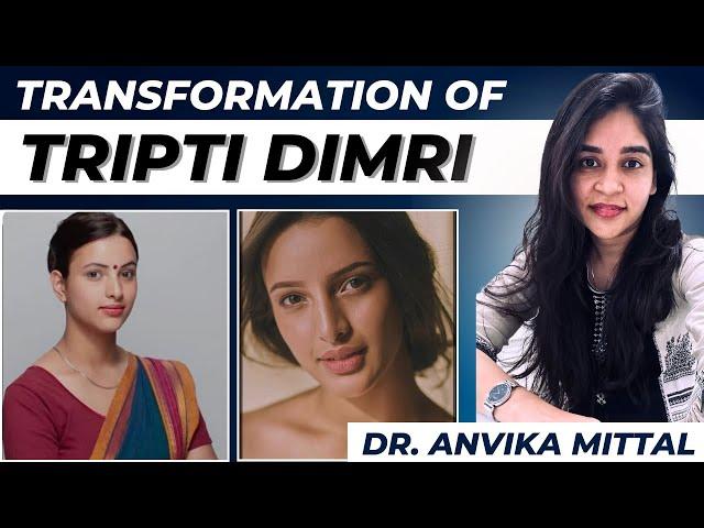 Transformation Of TRIPTI DIMRI | Explained By Dermatologist Dr. Anvika