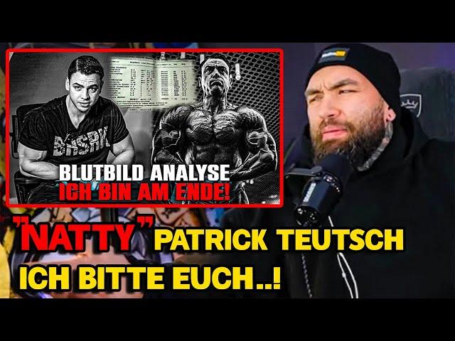 Der BEWEIS! Patrick Teutsch STOFFT!