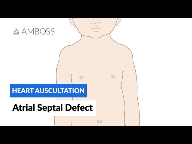 Atrial Septal Defect - Heart Auscultation - Episode 7