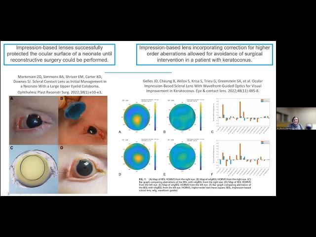 2022 Scleral Lens Research Update