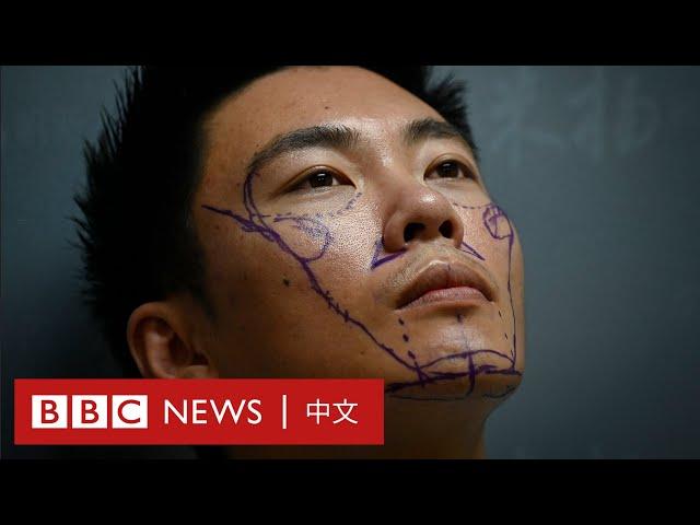 做美容手術的中國男人們：有人臉上動刀60次－ BBC News 中文