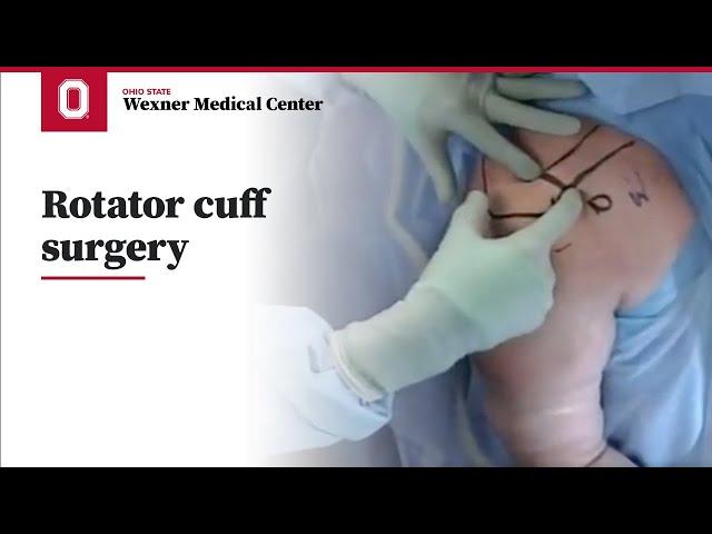 Rotator cuff surgery | Ohio State Medical Center