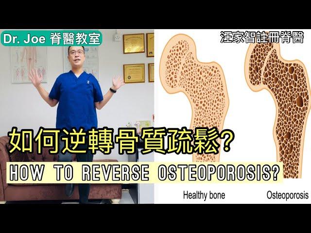 如何逆轉骨質疏鬆？ Dr Joe 教大家兩種方: 運動及營養[Eng Subtitles] How to Reverse Osteoporosis in 2 Steps.