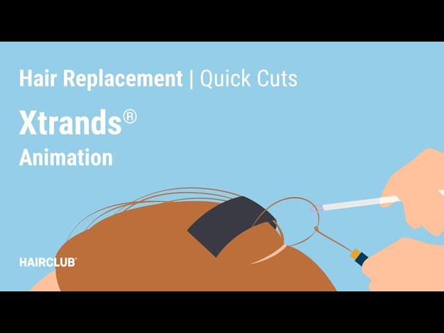 Check Out Xtrands by HairClub [Hair Loss Treatment Option]