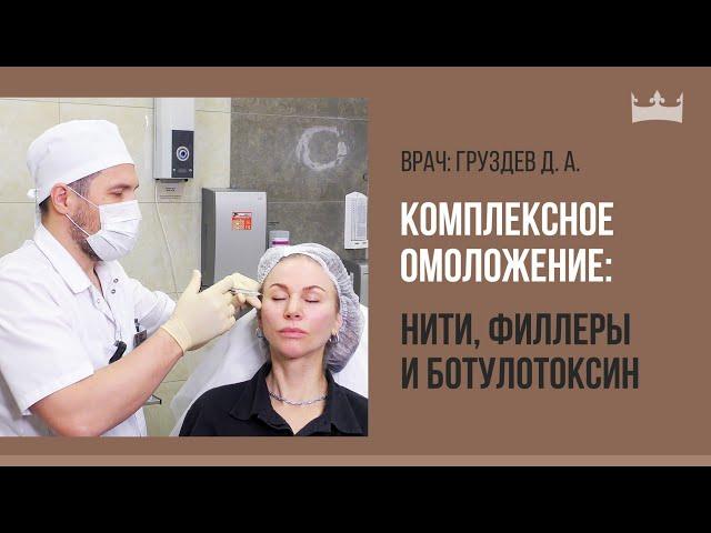 Комплексное омоложение лица: нити, филлеры и ботулотоксин