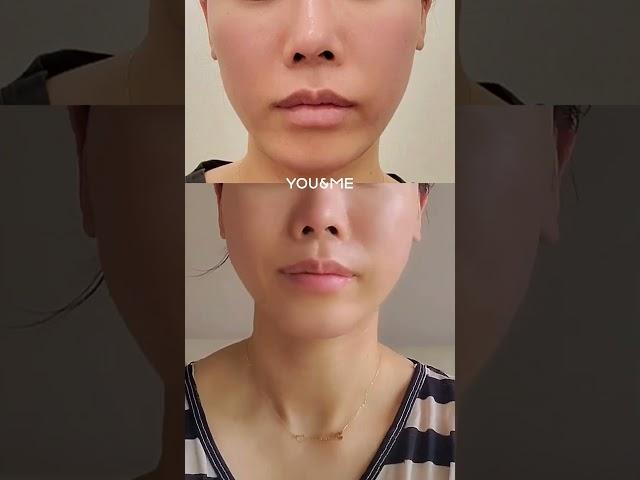 생기있는 바로 그 느낌 ‘실리프팅’으로 구현합니다