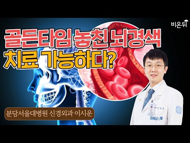 골든타임 놓친 뇌경색, 새로운 치료법이 나왔습니다(분당서울대병원 신경외과 이시운)