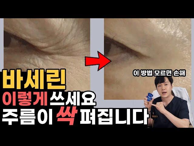 피부과 원장이 알려주는 바세린으로 주름없애는 방법