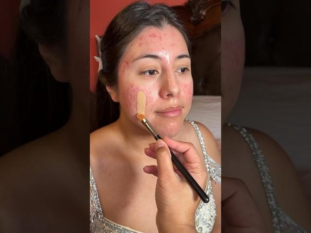 She asked if I could cover her acne scars #makeupartist #bridalmakeup #bridalhair #neetujosh #mua