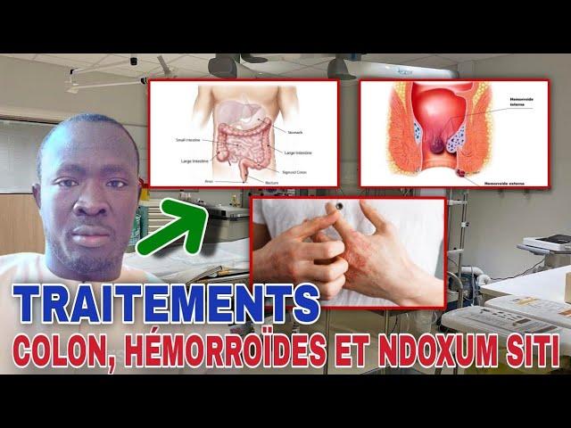 Solutions pour fadj fébarou Colon, hémorroïdes ak ndoxum siti, par Serigne Mor Astou Touré