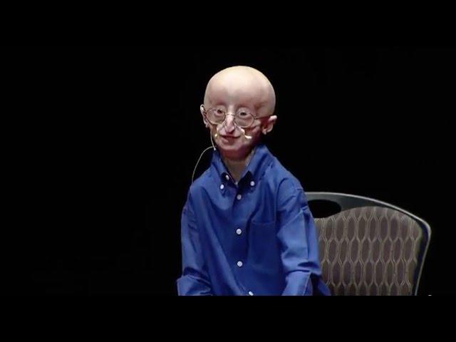 My philosophy for a happy life | Sam Berns | TEDxMidAtlantic