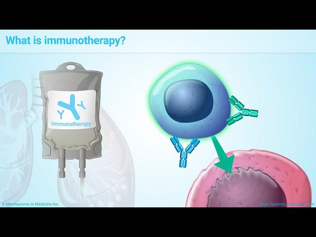 Understanding Immunotherapy for Lung Cancer