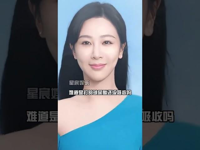 路人镜头才是明星“夺命杀手”！杨紫玻尿酸显现，张歆艺骨皮包骨