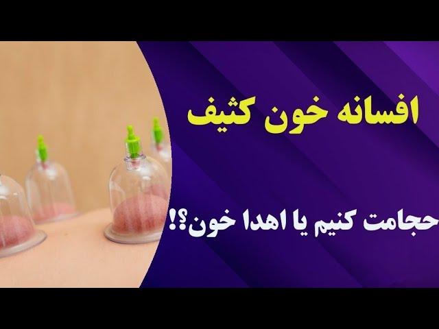 حجامت: رازهای ناگفته از این روش درمانی قدیمی و افسانه ای |Cupping therapy#حجامت