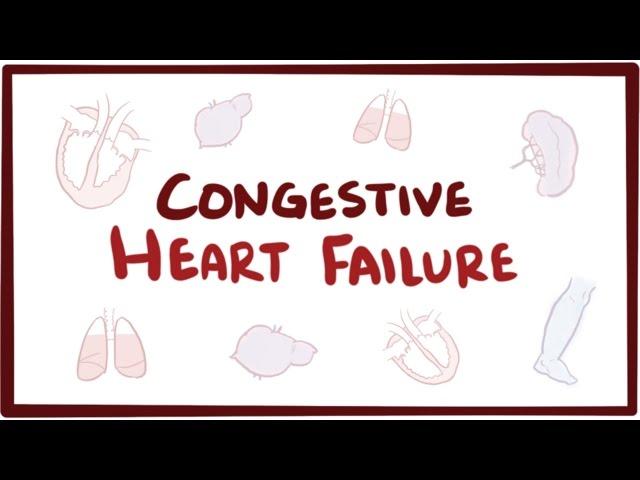 Congestive heart failure (CHF) - systolic, diastolic, left side, right side, & symptoms