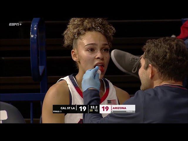 Jada Williams Hit In MOUTH: Arizona Wildcats Women's College Basketball vs Cal State LA | Big 12